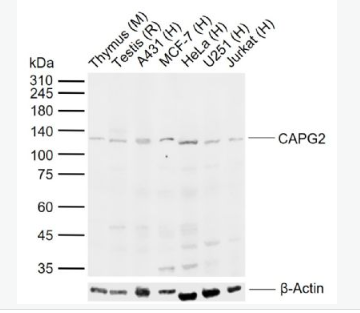 Anti-CAPG2 antibody-染色体相关蛋白2抗体