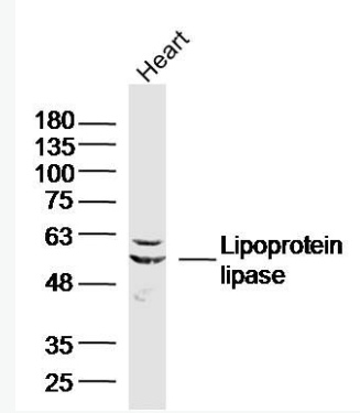 Anti-Lipoprotein lipase antibody-脂蛋白脂酶抗体