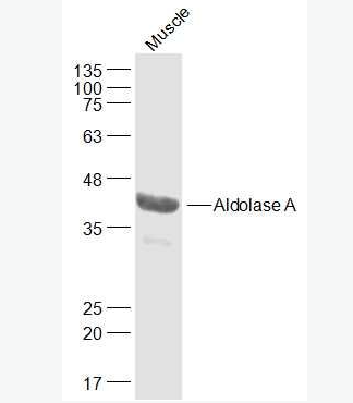 Anti-Aldolase A antibody-醛缩酶A抗体