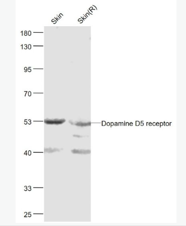 Anti-Dopamine D5 receptor antibody-多巴胺受体D5抗体