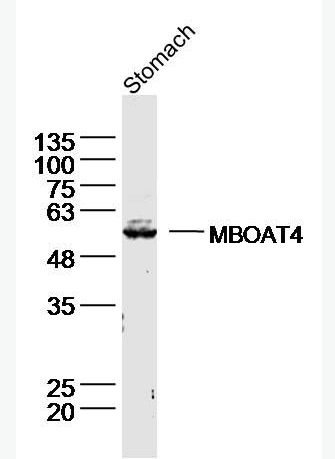 Anti-MBOAT4 antibody-脑肠肽O酰基转移酶/Ghrelin O acyltransferase抗体