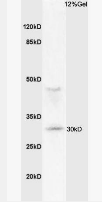 Anti-MHC Class II antibody-组织相容性复合体蛋白2（HLA-DMB）抗体