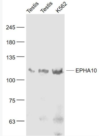 Anti-EPHA10 antibody-酪氨酸蛋白激酶受体A10抗体