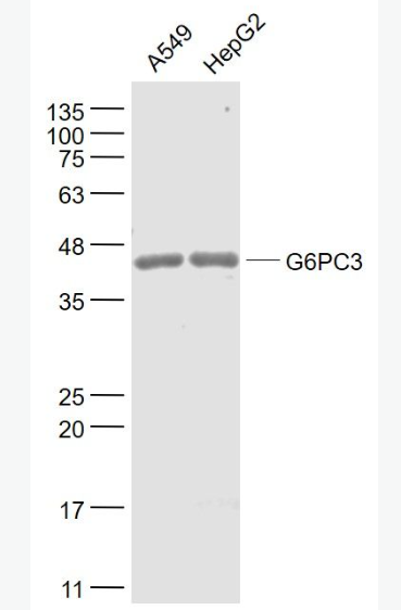 Anti-G6PC3 antibody-葡萄糖-6-磷酸酶3/G6Pase-β抗体