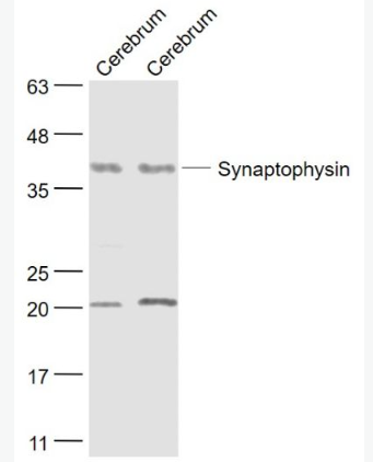 Anti-Synaptophysin antibody-突触小泡蛋白P38抗体