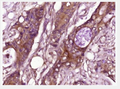 Anti-CCL26 antibody-趋化因子26/嗜酸粒细胞趋化蛋白3抗体