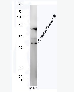 Anti-Creatine Kinase MB antibody-肌酸激酶同工酶CKMB抗体