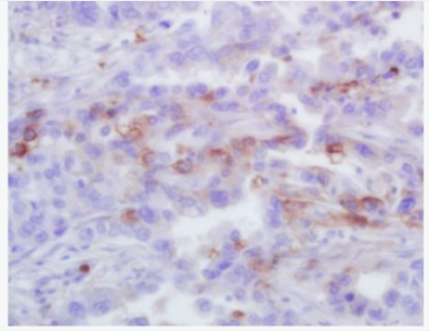 Anti-GRO Alpha antibody-黑色素瘤生长刺激活性蛋白α/GROa抗体