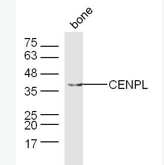 Anti-CENPL antibody-着丝粒蛋白L抗体