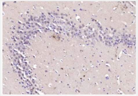 Anti-KMT3B antibody-雄激素受体辅活化因子267kda蛋白抗体