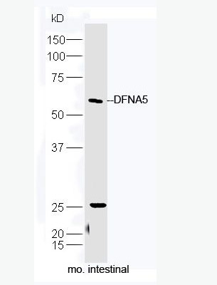Anti-DFNA5 antibody-耳聋相关常染色体显性遗传5抗体