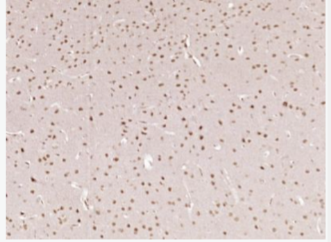 Anti-phospho-AMPK alpha 1 (Thr183) + AMPK alpha 2 (Thr172) antibody-磷酸化腺苷单磷酸活化蛋白激酶α1抗体