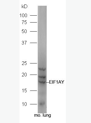 Anti-EIF1AY antibody-真核翻译起始因子1A抗体