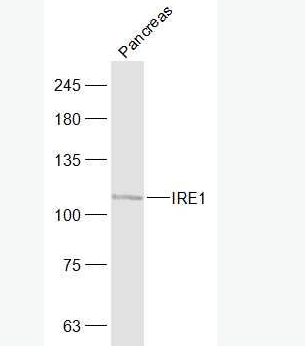 Anti-IRE1 antibody-IRE1蛋白抗体