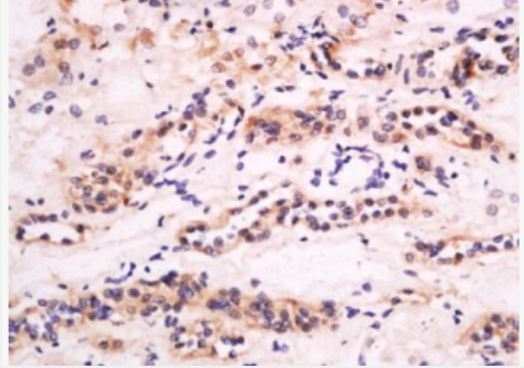 Anti-CXCL14 antibody-CXC趋化因子14抗体