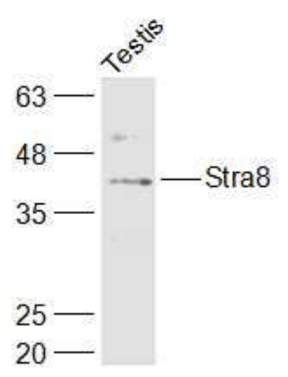 Anti-Stra8 antibody-视黄酸激活基因8抗体