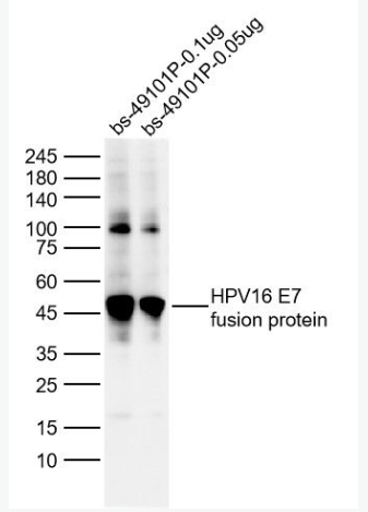 Anti-HPV16 E7  antibody-人乳头瘤病毒16型E7抗体