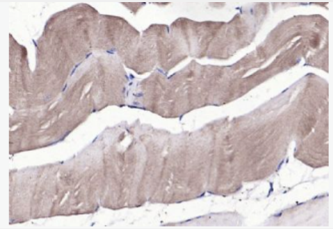 Anti-FGDF8 antibody-生长分化因子8抗体