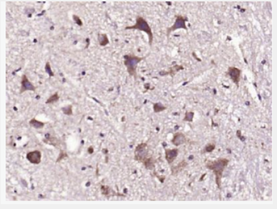 Anti-PMCA3  antibody-ATP酶钙离子转运蛋白PMCA3抗体