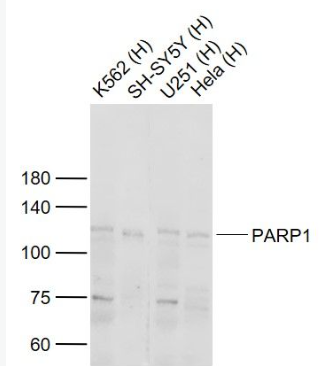 Anti-PARP1 antibody-多腺苷二磷酸多聚酶抗体/多聚ADP-核糖聚合酶1抗体