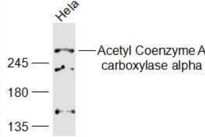 Anti-ACACA antibody-乙酰辅酶A羧化酶1/ACCα抗体