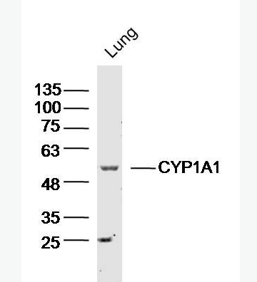 Anti-CYP1A1 antibody-细胞色素P450 1A1抗体
