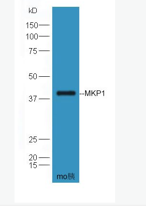 Anti-MKP1 antibody-丝裂原活化蛋白激酶磷酸酶-1抗体