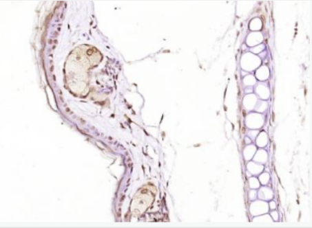 Anti-EBP1  antibody-erbB3结合蛋白1抗体