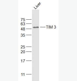 Anti-HAVCR2/TIM-3antibody-T淋巴细胞膜蛋白3（CD366）抗体