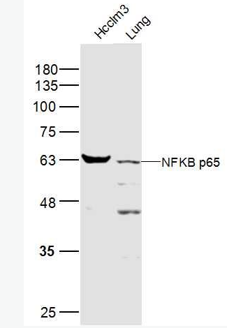 Anti-NFKB p65 antibody-细胞核因子NFKBp65抗体