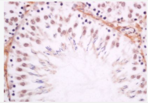 Anti-Dmrta1 antibody-性发育转录因子蛋白DMO抗体