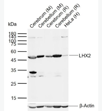 Anti-LHX2 antibody-调控胚胎干细胞分化蛋白Lhx2抗体