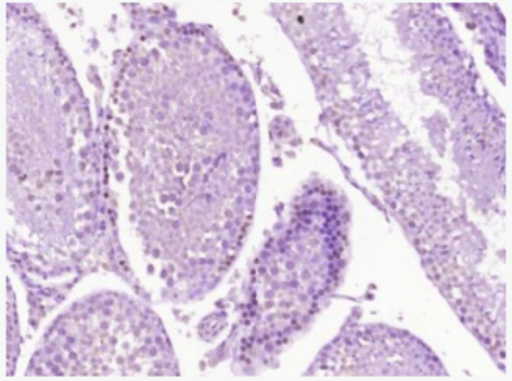 Anti-CTNND1 antibody-连环蛋白delta-1抗体