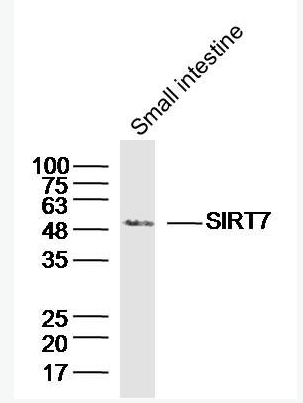 Anti-SIRT7 antibody-沉默调节样蛋白SirT7抗体