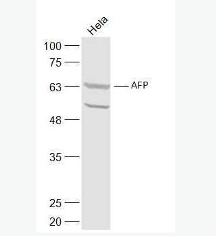 Anti-AFP antibody-甲胎蛋白抗体
