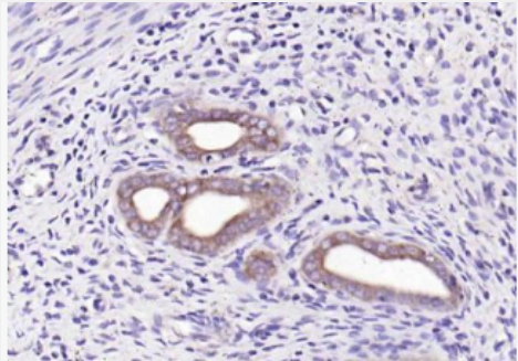 Anti-WNT7B antibody-Wnt蛋白家族7B抗体