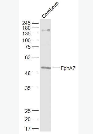 Anti-EphA7  antibody-酪氨酸蛋白激酶受体A7抗体