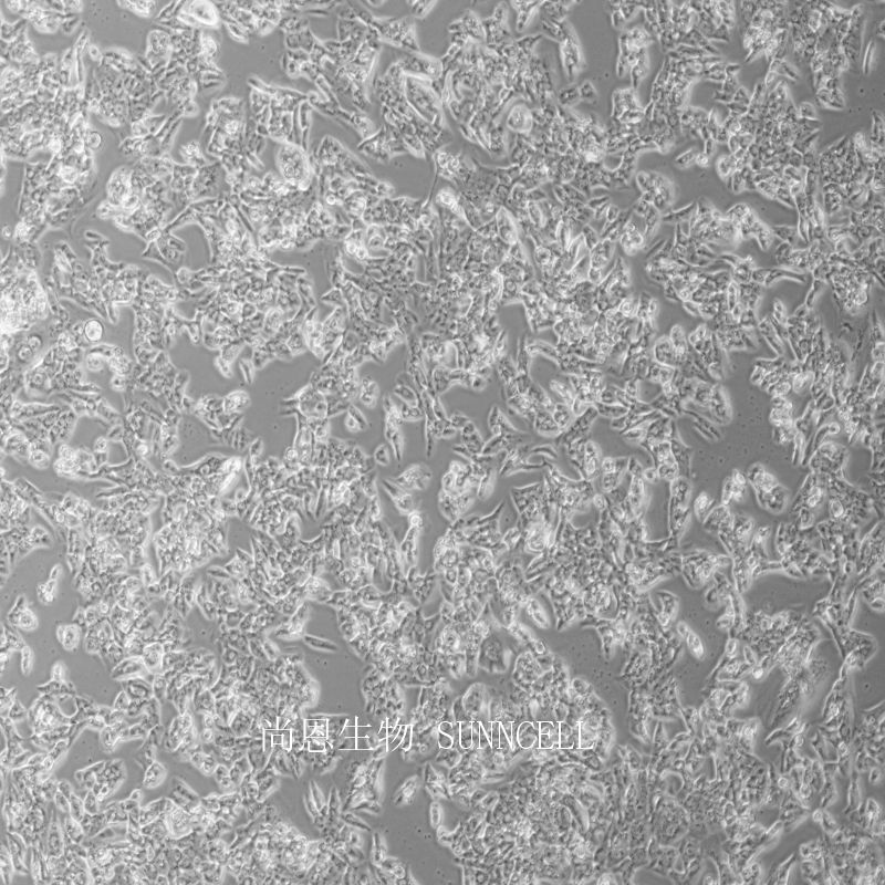 小鼠睾丸间质细胞瘤细胞