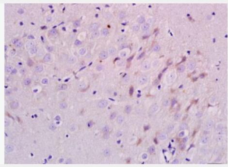 Anti-ERBB3 antibody-表皮生长因子受体3抗体