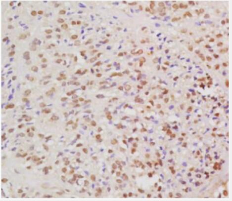 Anti-HPV16 E6 antibody-人类乳头状瘤病毒16抗体