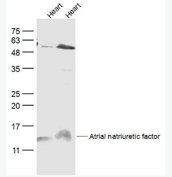 Anti-Atrial natriuretic factor antibody-心房钠尿因子/心钠素/心房利钠肽/ANP抗体