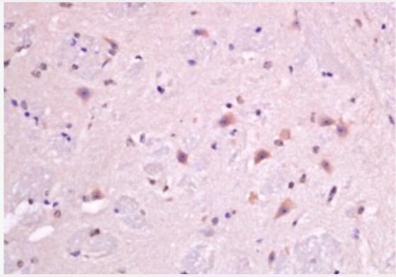 Anti-Macrophage Inflammatory Protein 1 gamma antibody-巨噬细胞炎症蛋白-1γ抗体