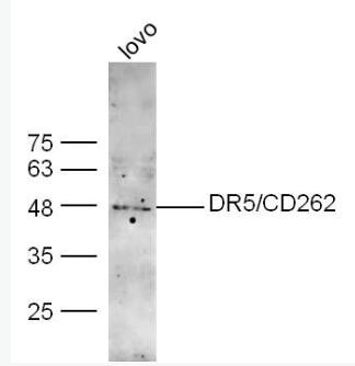 Anti-DR5  antibody-肿瘤细胞调亡素/死亡受体5抗体