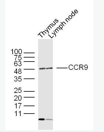 Anti-CCR9 antibody-细胞表面趋化因子受体9抗体