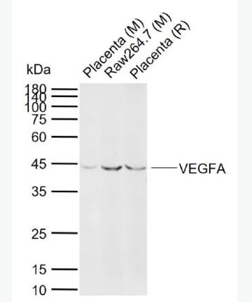 Anti-VEGFA antibody-血管内皮生长因子A抗体