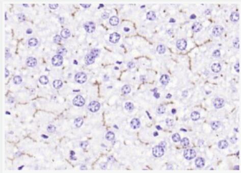 Anti-ABCB11 antibody-胆汁酸盐输出泵抗体