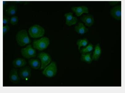 Anti-PDCD1LG2 antibody-程序性死亡配体2（CD273）抗体
