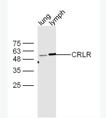 Anti-CALCRL antibody-降钙素基因相关肽1型受体抗体