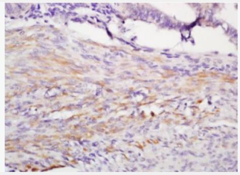 Anti-IGFBP1 antibody-胰岛素样生长因子结合蛋白1抗体