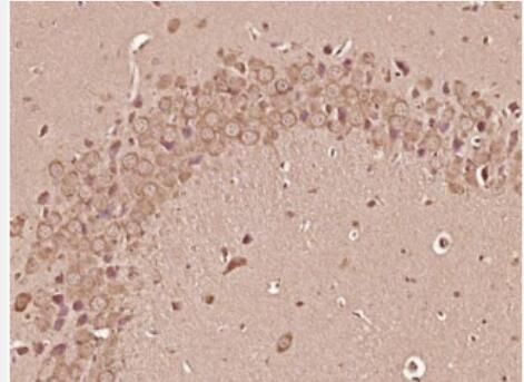 Anti-HDAC2 antibody-组蛋白去乙酰化酶2抗体